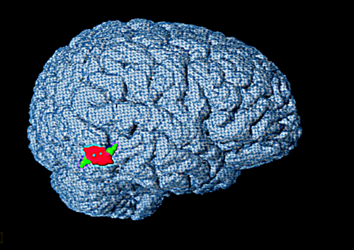 Pidgin lobe